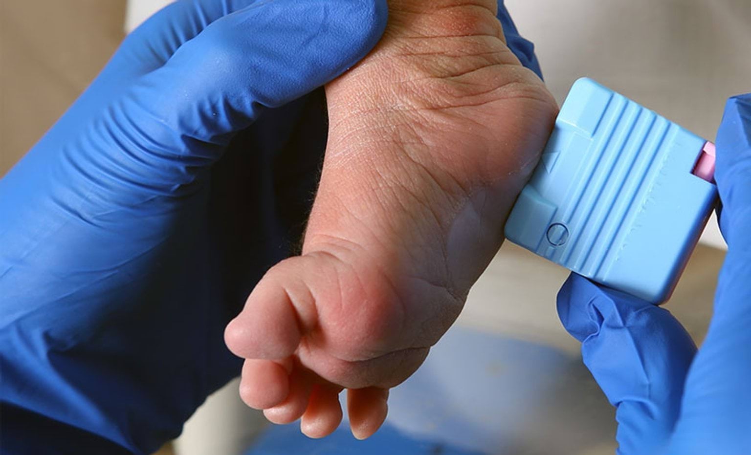 baby foot being held by blue gloved hands
