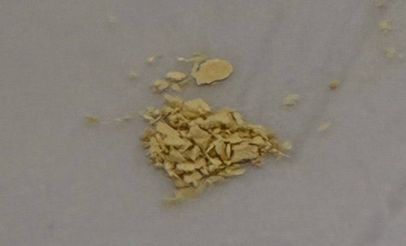 N-Desethyl Etonitazene, a novel synthetic opioid